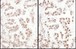 SFRS4 Antibody, Novus Biologicals 0.1mg; Unlabeled:Antibodies, Polyclonal